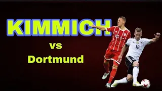KIMMICH‘S goal at the derby against Dortmund !