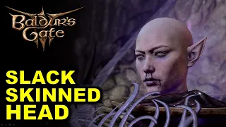 Talking to Slack-Skinned Head in Necrotic Laboratory | Mind Flayer Colony | Baldur's Gate 3 (BG3)