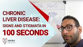 Chronic Liver Disease: Signs and Stigmata in 100 seconds