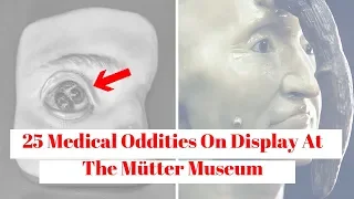 25 Medical Oddities On Display At The Mütter Museum