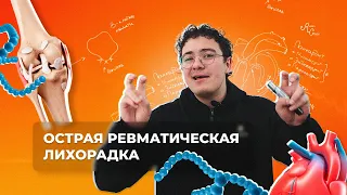 Острая ревматическая лихорадка