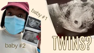 Twins + Baby 1st Ultrasound + High HCG Levels | BOBH (EP:3)