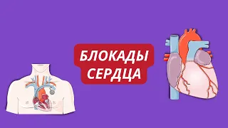 Блокады сердца 🫀 виды, с чем связаны, как распознать на ЭКГ?