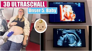 Unser 5. Baby 🥹 3D Ultraschall & Feindiagnostik | 22 SSW | Isabeau