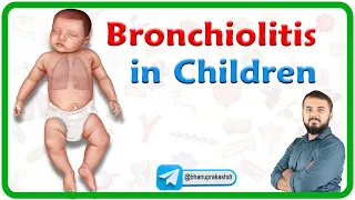 Bronchiolitis in Children : Etiology, Clinical features, Diagnosis, Management and Complications