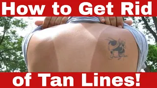 Proven Methods: How to Get Rid of Tan Lines FAST!