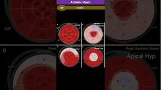 Athletic Heart