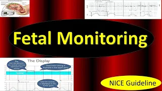 Fetal Monitoring in Labor, NICE Guideline (2022) / Updates in Cardiotocography, CTG