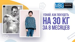 Минус 30 кг за 8 месяцев | Отзыв пациента после операции Бандажирование желудка