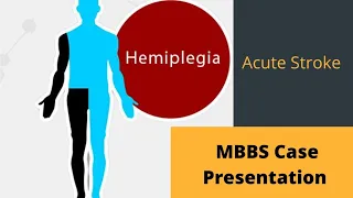 MBBS case presentation || Hemiplegia