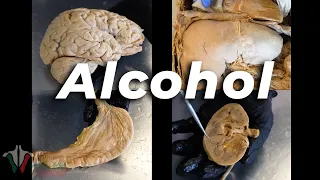 Lo que EL ALCOHOL le hace a tu cuerpo.
