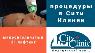 Микроигольчатый РФ лифтинг