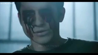 Teen Wolf 6x20- Soctt "Blinds himself"!