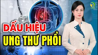 8 triệu chứng sớm nhất báo hiệu ung thư phổi - KHOẺ TỰ NHIÊN