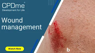 Wound Management Presented By Maj Pieter Vermaak