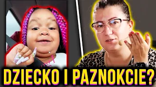 PAZNOKCIOWA KONTROWERSJA - DZIECKO I PAZNOKCIE [LUP] #49