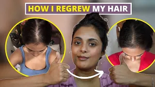 my hair loss journey and how I am growing it back