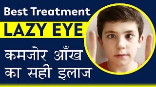 Is your child suffering from Lazy Eye & you are unaware ? कमजोर आँख का सही इलाज  Amblyopia treatment