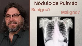 Nodulo Pulmonar: o que é e o que fazer?