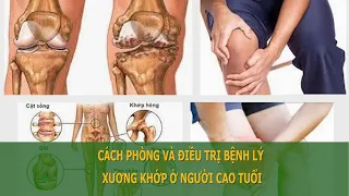 [Trực tiếp] CÁCH PHÒNG VÀ ĐIỀU TRỊ BỆNH LÝ XƯƠNG KHỚP Ở NGƯỜI CAO TUỔI | Sức khỏe vàng VTC16