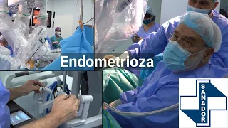 Endometrioza – Dr. Bogdan Marțian | Spitalul Clinic SANADOR