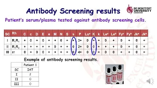 Antibody Screening detection test: an  IAT application