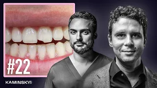 Как отличить хорошего стоматолога от плохого? ВИНИРЫ. Доктор Дмитрий Аверин. ХИТ-ФАКАП / KAMINSKYI