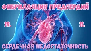 Вебинар 30. Фибрилляция предсердий и сердечная недостаточность.