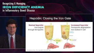 Understanding Iron Deficiency Anemia in Gastroenterology: Who and Why?