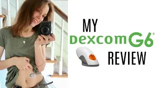 My Dexcom G6 Review | She's Diabetic