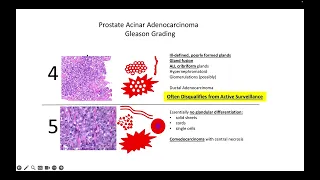 GU Pathology review: Kurt's Notes #pathagonia