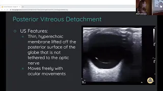 Drs Shtridler and Kilpatrick   Ocular Ultrasound