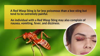 10 Effective Home Remedies for Red Wasp Sting