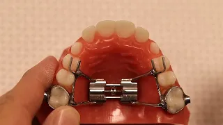 Turning the Expander