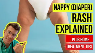 What  are SYMPTOMS OF NAPPY (DIAPER) RASH and HOW DO I TREAT it at home | Doctor O'Donovan explains!