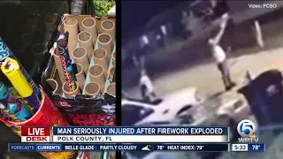 Florida man holding beer has firework explode in his hand