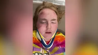 'He had been trampled': Stark County teen injured during deadly Astroworld Music Festival