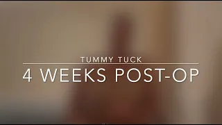 Tummy Tuck Journey: 2-4 Weeks Post Op