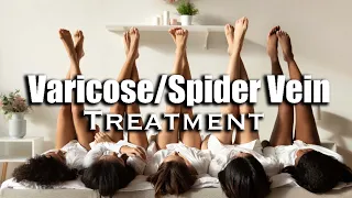 Spider/Varicose Vein Treatment (Morphic Field)