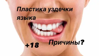 Пластика уздечки языка? Зачем это нужно?#клиникамосква #стоматология #хирургия