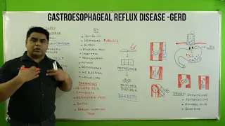 gerd in hindi | GERD NCLEX | gastroesphageal reflux disease in hindi  | gerd treatment | nursing