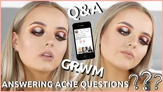CHATTY CHRISTMAS FULL COVERAGE ACNE GRWM | ANSWERING YOUR QUESTIONS | NEW MAKEUP | Conagh Kathleen