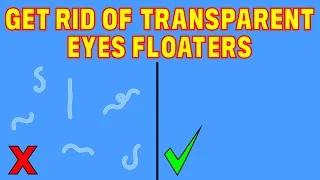 The 2 step natural solution for transparent eye floaters