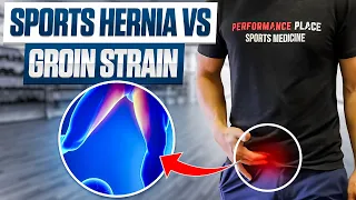 Sports Hernia vs. Groin Strain: Unraveling the Differences