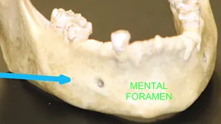 the MANDIBLE