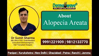 Alopecia Areata Signs, Symptoms, Causes & Hair Regrowth Treatments | Alopecia Treatment - Dermawave
