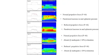 Anorectal manometry