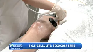 Cellulite: ecco cosa fare