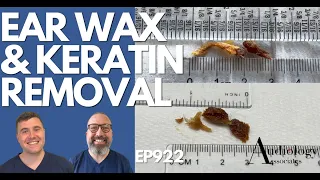 EAR WAX & KERATIN REMOVAL - EP922