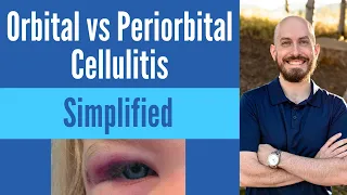 Orbital vs Periorbital Cellulitis [Basics for New Clinicians, Students, other Beginners]